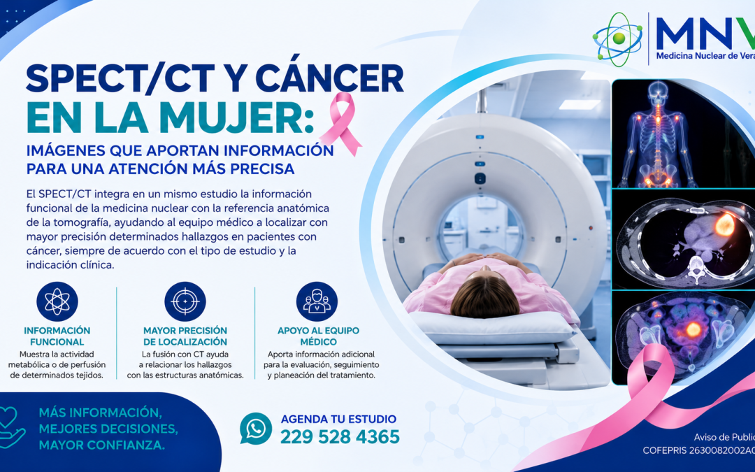 SPECT/CT y cáncer en la mujer: imágenes que aportan información para una atención más precisa